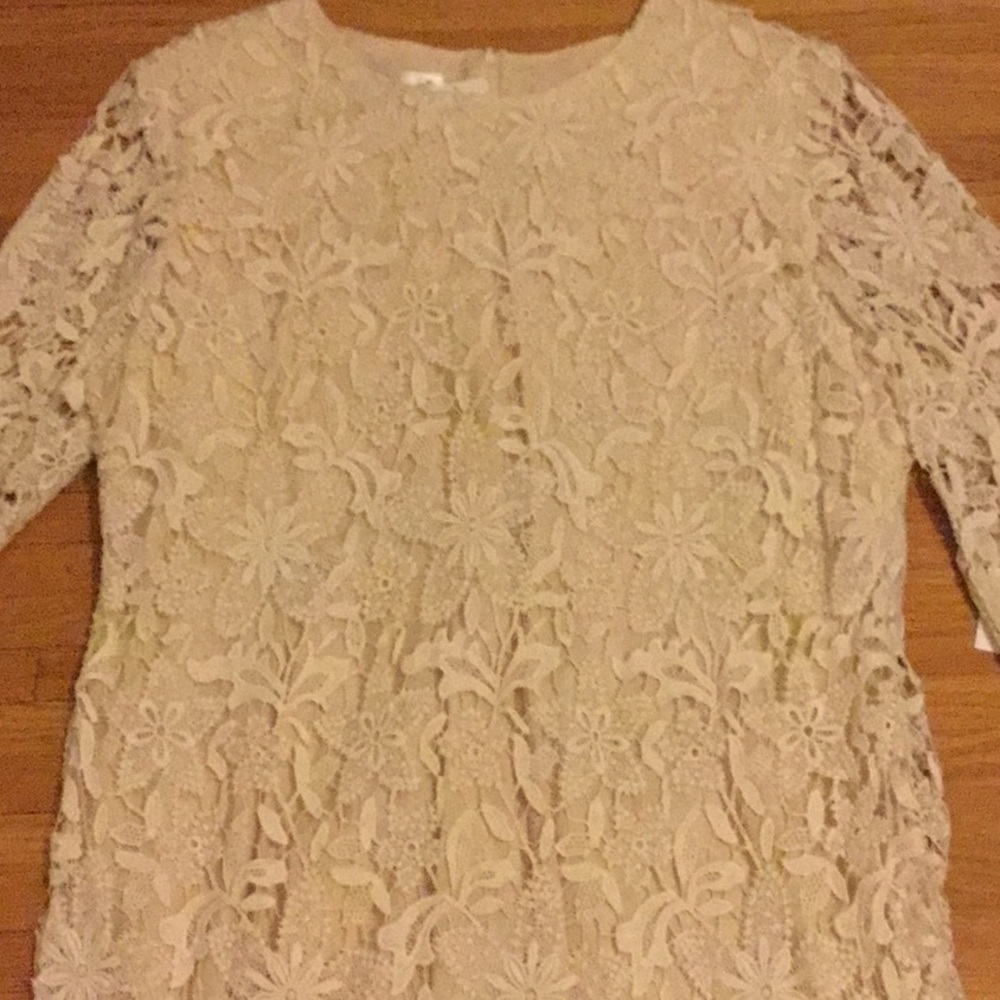 JSong cotton lace dress 20